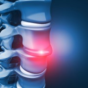 Seeking treatment for back pain?