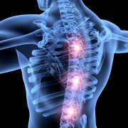 Endoscopic spinal surgery to treat back pain
