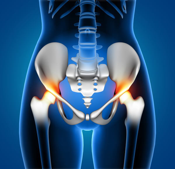 Achieving Swift Recovery: Enhanced Recovery (ERAS) Direct Anterior Approach Total Hip Replacement