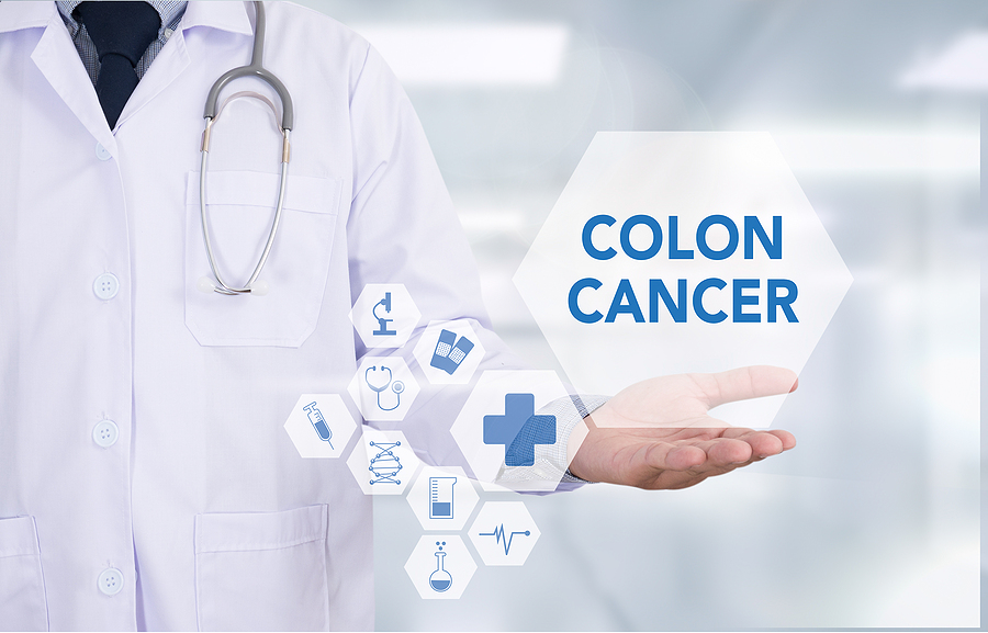 Rising Rates of Colorectal Cancer In Younger Age Groups